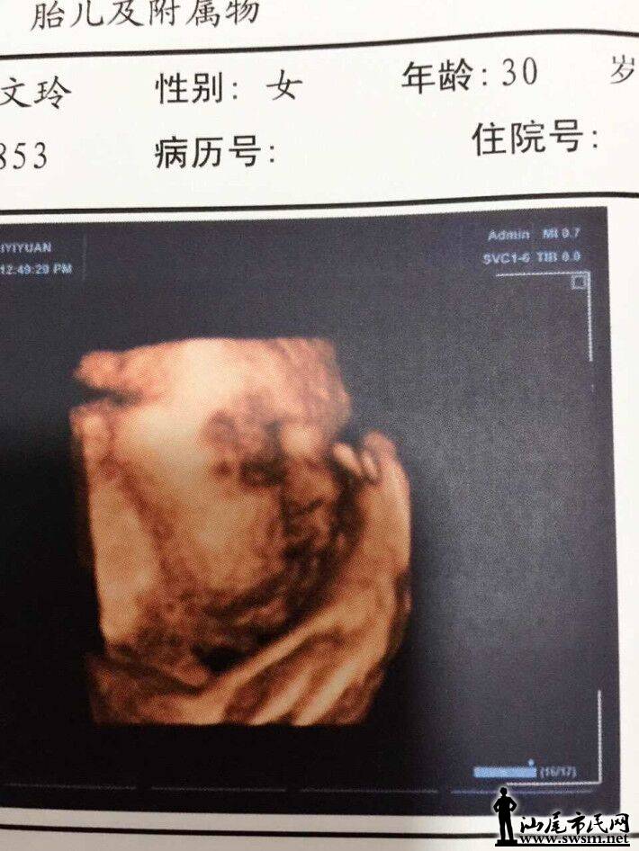 QQͼƬ20160302161234.jpg