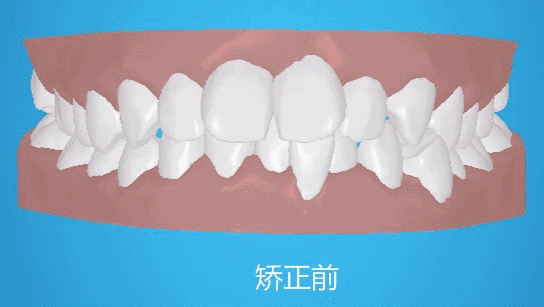 ΢ͼƬ_20221106184011.gif